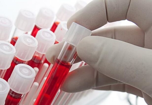 Алкогольді ішкеннен кейін қан анализі